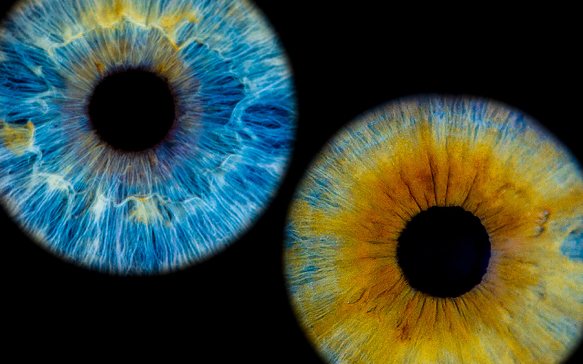 Irisfotografie einer blauen Iris und einer bräunlich, grünlichen Iris.